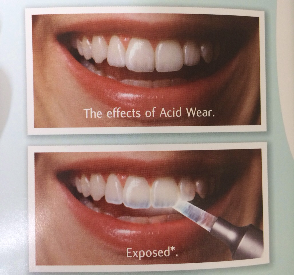 Protect Teeth Against Acid Wear 😬 Trusper