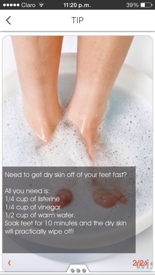 How To Get Dry Skin Off Your Feet Trusper