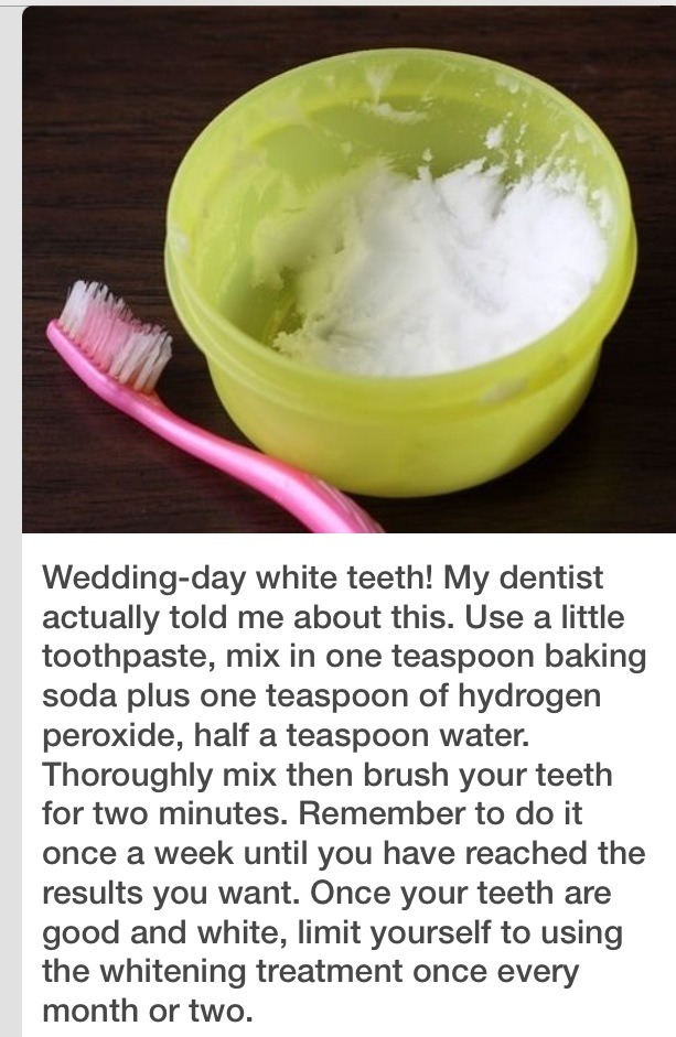 Watch 10 Tips for Whiter Teeth video Watch 10 Tips for Whiter Teeth video