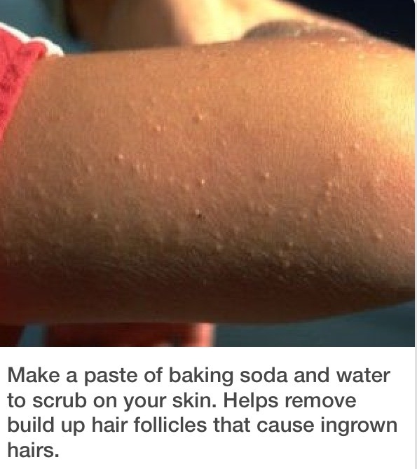 Cheap and Easy Way To Get Rid Of Bumps On Your Arms And Thighs 