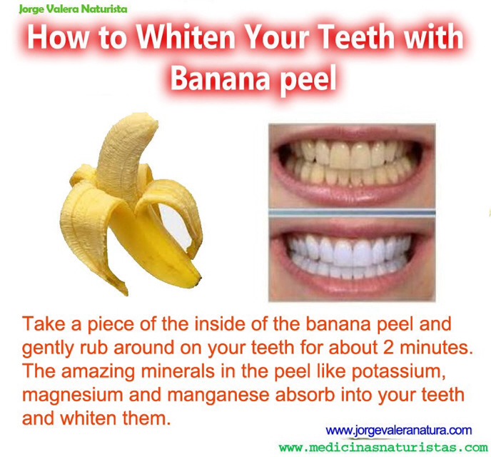 Use The Inside Of A Banana Peel As Tooth Whitening, The Potassium And