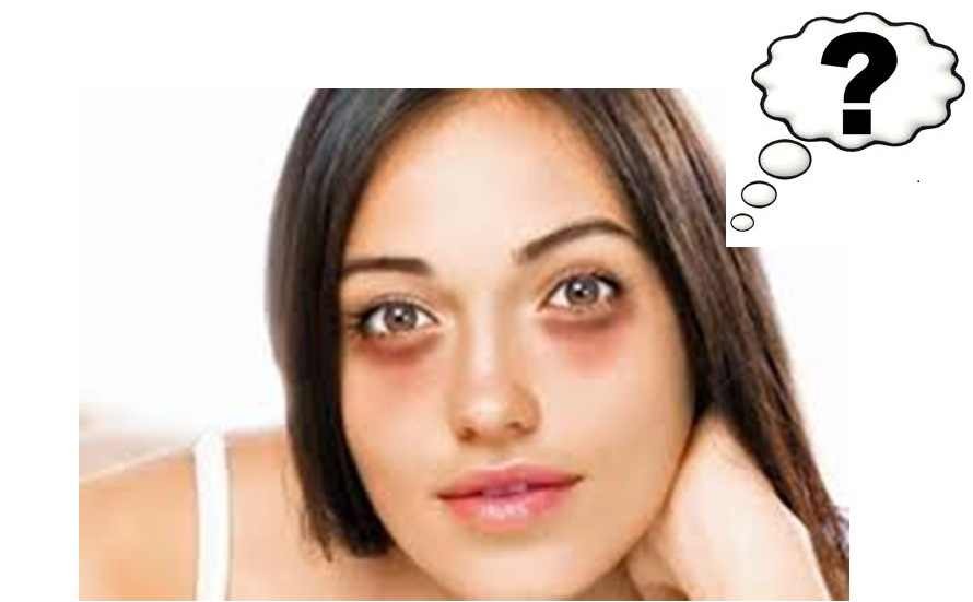 How Do I Get Rid Of Freckles Apps Directories