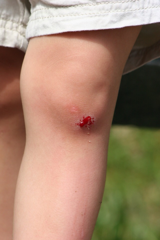 Cut A Hole In A Pacifier To Make Giving Medicine Easier For Babies