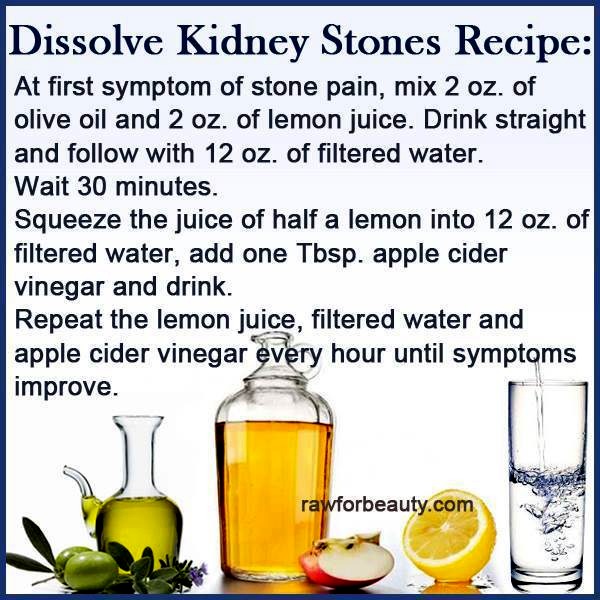Natural Products To Dissolve Kidney Stones Natural Products To Dissolve Kidney Stones