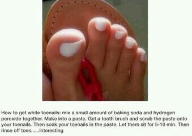 How To Whiten Yellow Nails | Trusper