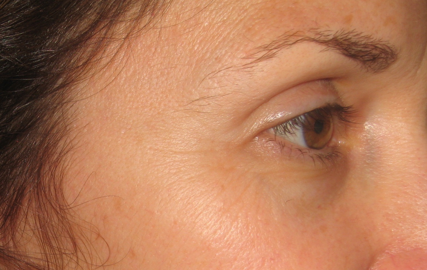 How To Reduce Eye Wrinkles In A Natural Way How To Reduce Eye Wrinkles In A Natural Way