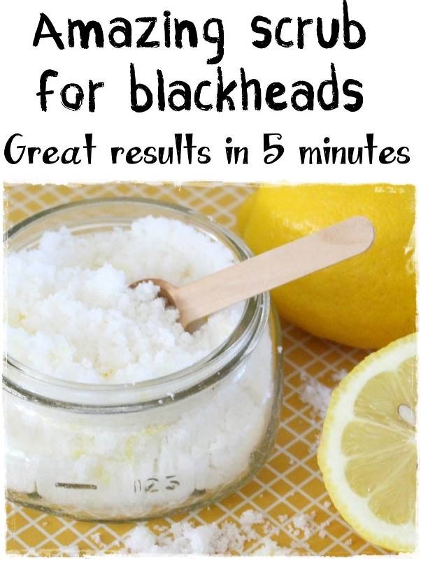 😇 5 Best Homemade Blackhead Remover Scrubs 😇 | Trusper