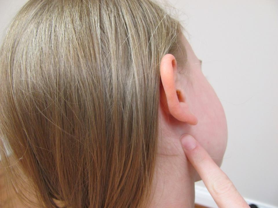 Homemade Natural Remedies For Ear Infection Trusper