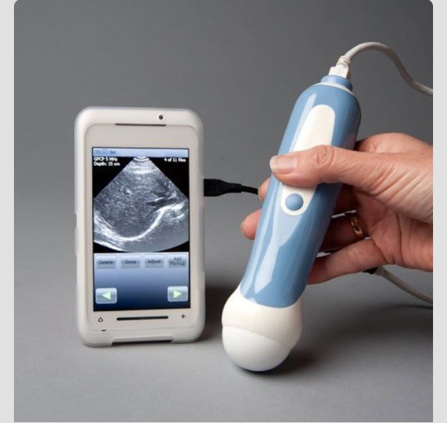 You Can Get An Ultrasound Attachment For Your IPhone! Trusper