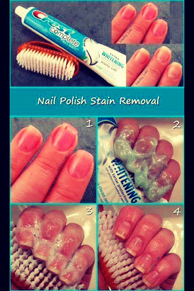 Whiten Your Yellowish Nails Caused By Nail Polish!!💅 Trusper