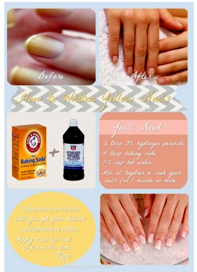 How To Whiten Yellow Nails Trusper