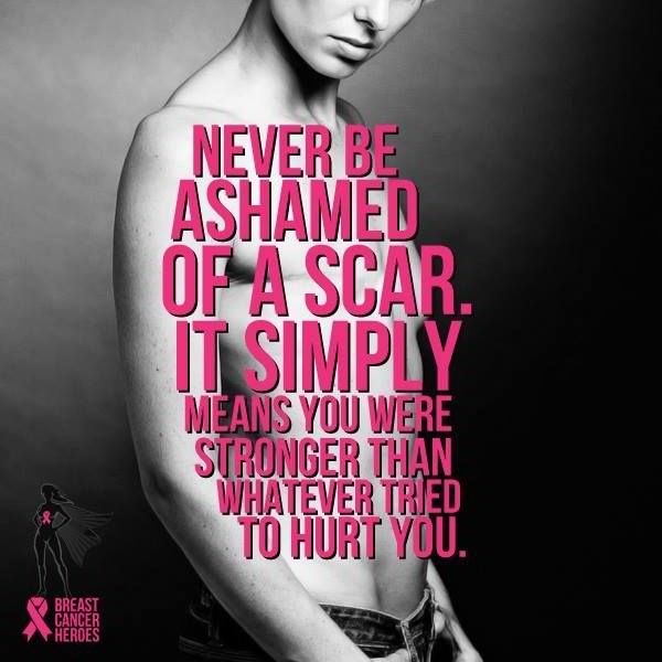 Never Be Ashamed Of A Scar, It Simply Means You Were Stronger Then