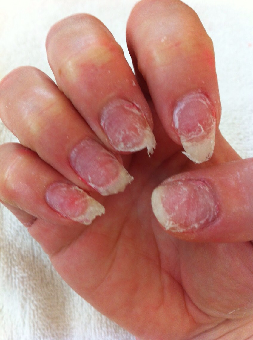 Acrylics Thin Out Your Nails Trusper