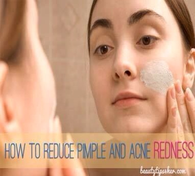 How To Reduce Pimple & Acne Redness
