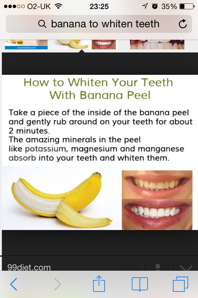 You Can Use A Banana Peel To Whiten Your Teeth. It May Seem Crazy But