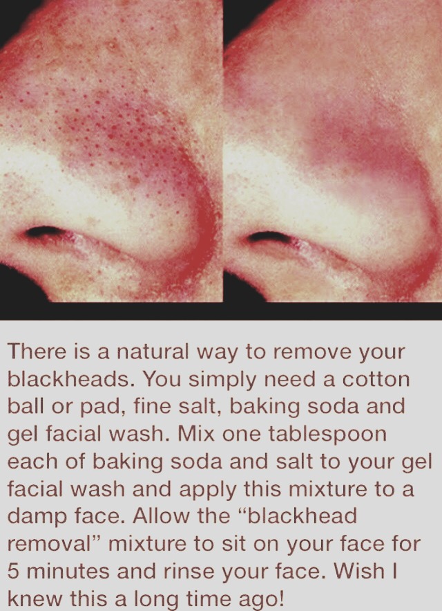 How To Get Rid Of Dark Circles Naturally Faster How To Get Rid Of Dark Circles Naturally Faster
